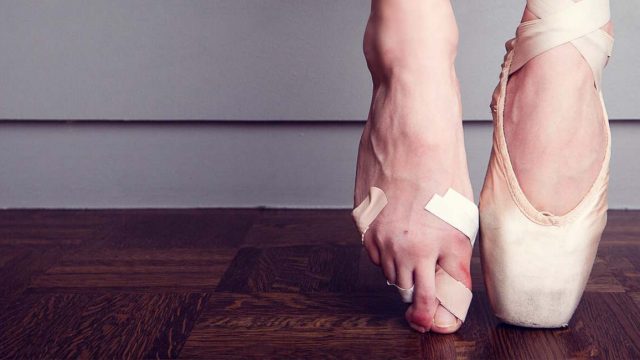 Butler Ballet members suffer injuries each year